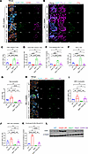 Chi3l1 OE suppresses antitumor immune responses.