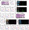 Neutrophil depletion abrogates the effects of Chi3l1 OE.