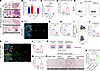 Chi3l1 OE enhances metastatic dissemination through neutrophil-mediated ECM