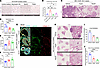 Neutrophil degranulation and NETosis promote ECM remodeling.