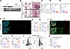 Chi3l1 ablation inhibits breast cancer metastasis.