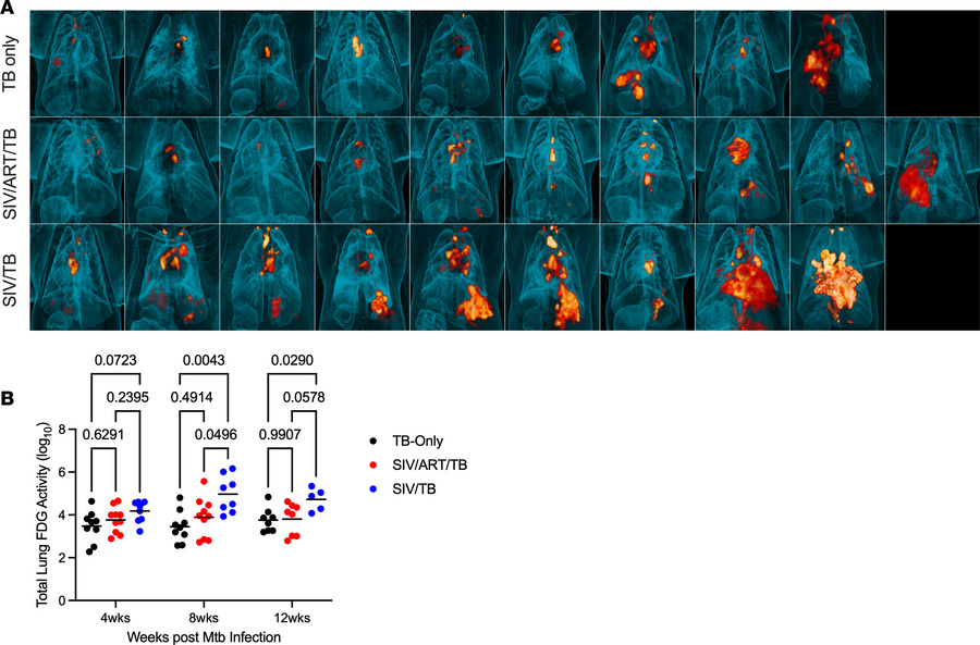 PET-CT images of tuberculosis-involved lung and thoracic LN at necropsy....