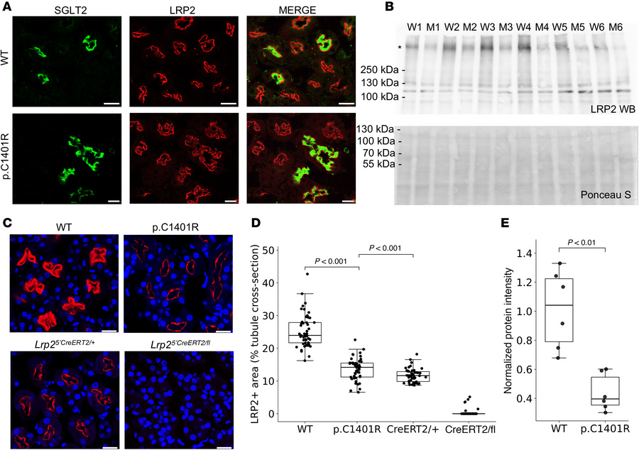 LRP2 p.C1401R is expressed apically.
(A) Immunofluorescence (IF) for SGL...