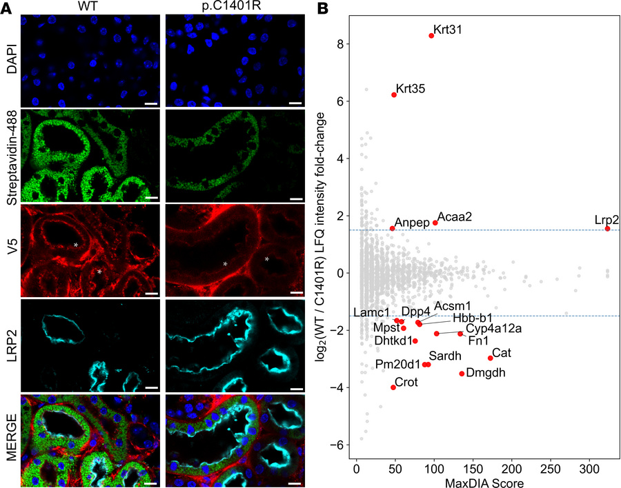 LRP2 p.C1401R and WT are differentially biotinylated by V5-APEX2-RAP.
(A...