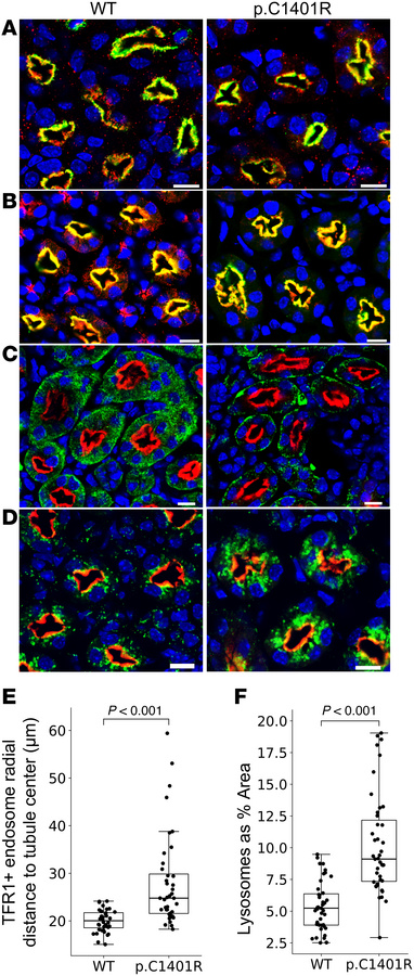 LRP2 p.C1401R perturbs endocytic flux.
IF of WT and Lrp2 p.C1401R mice (...