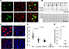LRP2 p.C1401R is expressed apically.