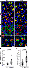 LRP2 p.C1401R perturbs endocytic flux.