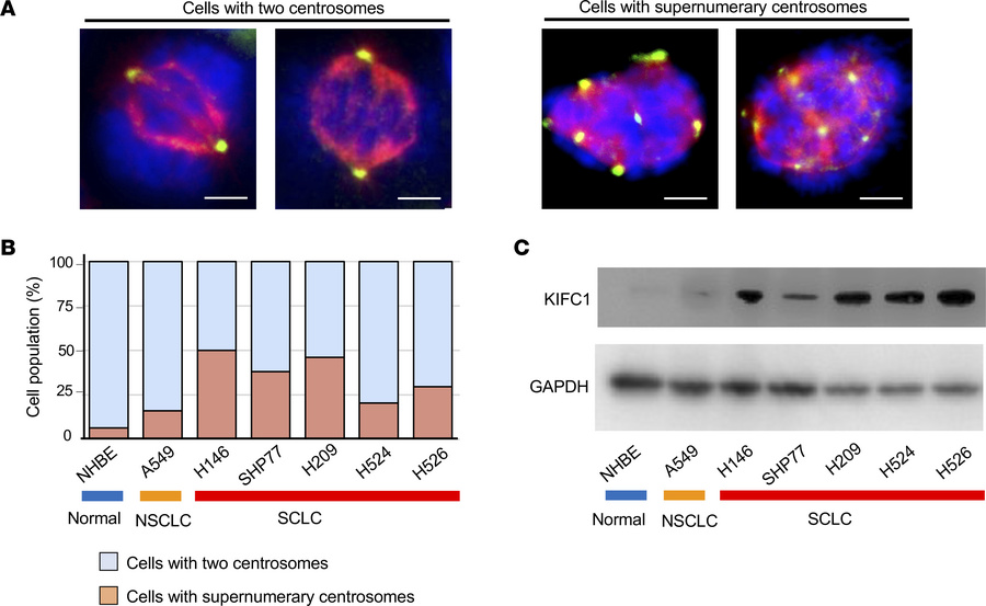 Frequent supernumerary centrosomes and elevated KIFC1 protein levels in ...