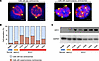 Frequent supernumerary centrosomes and elevated KIFC1 protein levels in SCL