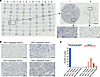 IHC analysis of KIFC1 protein expression in paired SCLC and adjacent normal