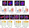 Induction of anaphase catastrophe in SCLC cells following KIFC1 inhibition.