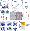 In vivo antitumor effects of AZ82 treatment in SCLC.