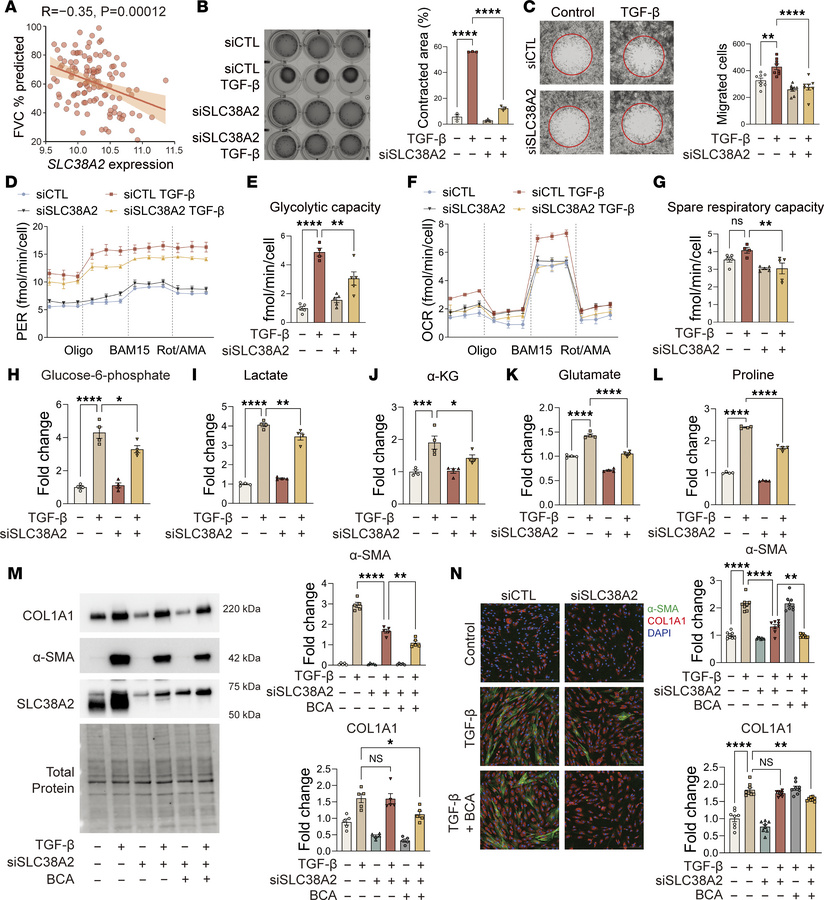 SLC38A2 and GPT2 cooperatively promote TGF-β–induced fibrogenic response...