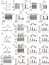 Glutamine promotes TGF-β–induced GPT2 expression to support myofibroblast d