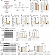 Alanine sustains myofibroblast differentiation by compensating for glutamin