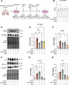 Dual inhibition of alanine uptake and synthesis alleviates pulmonary fibros