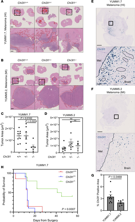 Loss of CHI3L1 decreases tumor burden in murine models of HI, but not MI...