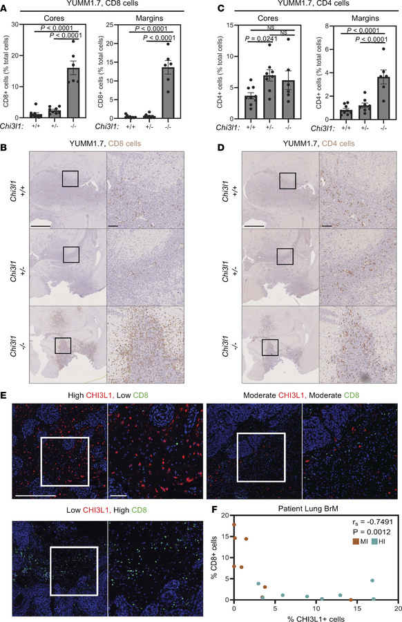 CHI3L1 levels are negatively associated with T cell infiltrate in murine...