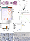 NanoString Digital Spatial Profiling reveals augmented interferon-γ signali