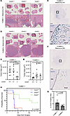 Loss of CHI3L1 decreases tumor burden in murine models of HI, but not MI, B