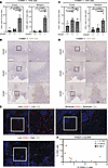 CHI3L1 levels are negatively associated with T cell infiltrate in murine mo