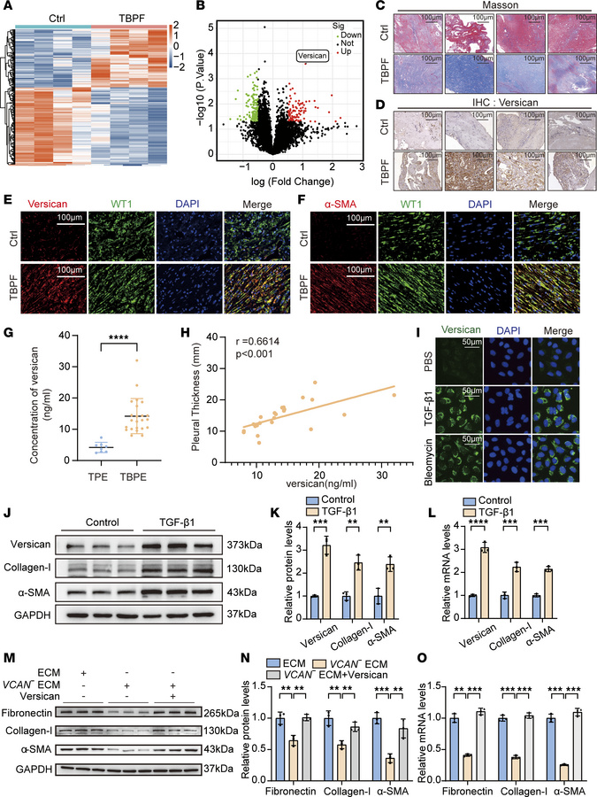 Versican expression was upregulated in pleural fibrosis.
(A) Protein pro...