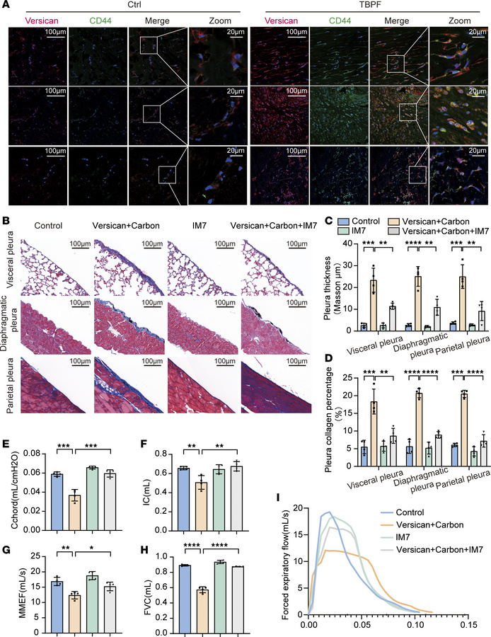 Anti-mouse CD44 neutralizing antibody (IM7) alleviated versican-mediated...