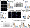 CD44 upregulated and mediated fibrotic phenotype in PMCs.