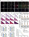 Anti-mouse CD44 neutralizing antibody (IM7) alleviated versican-mediated pl