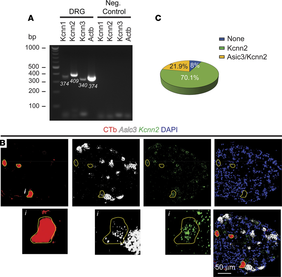 SK2 channels are expressed in bladder sensory neurons.
(A) RT-PCR confir...