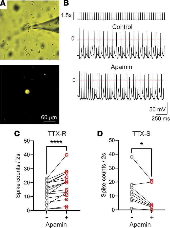 SK channels regulate DRG neuron firing.
(A) Bright-field (top) and epifl...
