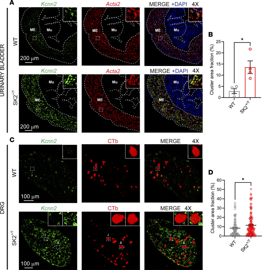 Overexpression of Kcnn2 in transgenic SK2 mice.
FISH and immuno-FISH con...