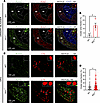 Overexpression of Kcnn2 in transgenic SK2 mice.