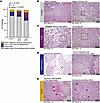 Maternal OUD±HCV is associated with inflammation and fetal/maternal vascula