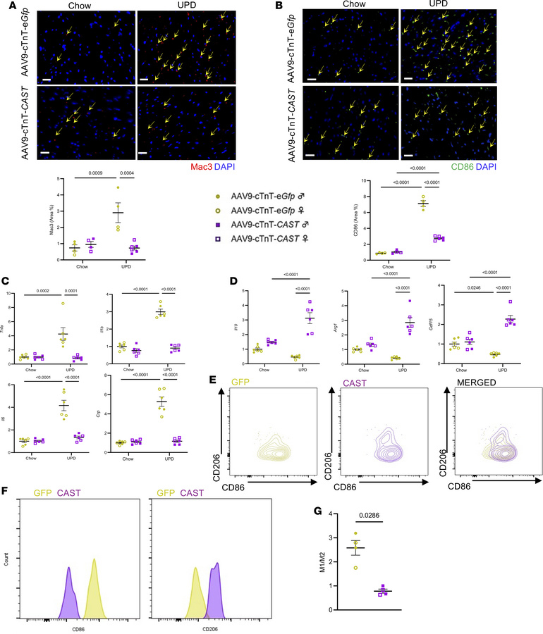 Cardiac-specific calpain inhibition reduces ultra-processed diet–induced...