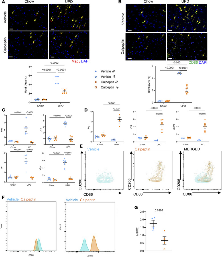 Pharmacological inhibition of calpain reduces ultra-processed diet–induc...
