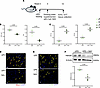 Pharmacological inhibitor of reactive oxygen species (ROS) reduces cardiac
