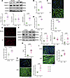 Oxidative stress is associated with increased cardiac HMGB1 and calpain-1 u