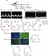 Cardiac-specific calpain inhibition reduces ultra-processed diet–induced ca
