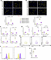 Cardiac-specific calpain inhibition reduces ultra-processed diet–induced ca