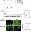 Cardiac-specific calpain inhibition decreases cardiac HMGB1.