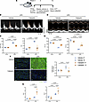 Pharmacological inhibition of calpain reduces ultra-processed diet–induced