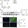 Pharmacological inhibition of calpain decreases cardiac HMGB1.