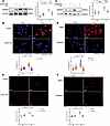 Inhibition of calpain alleviates oxidative stress and HMGB1 in neonatal rat