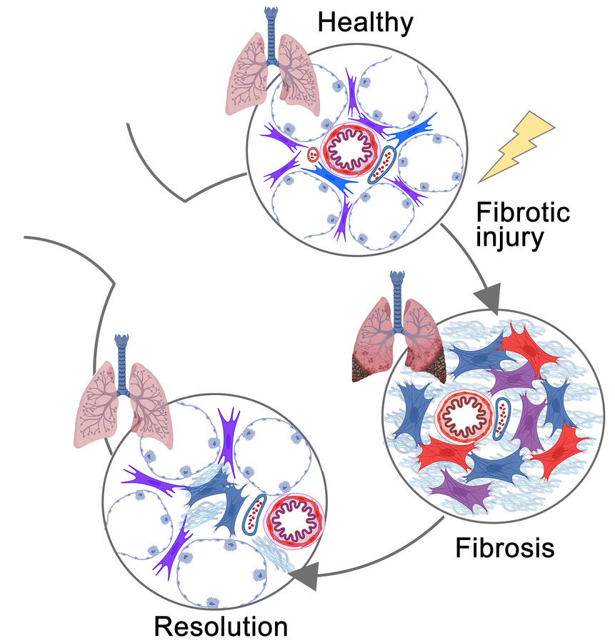 graphical abstract