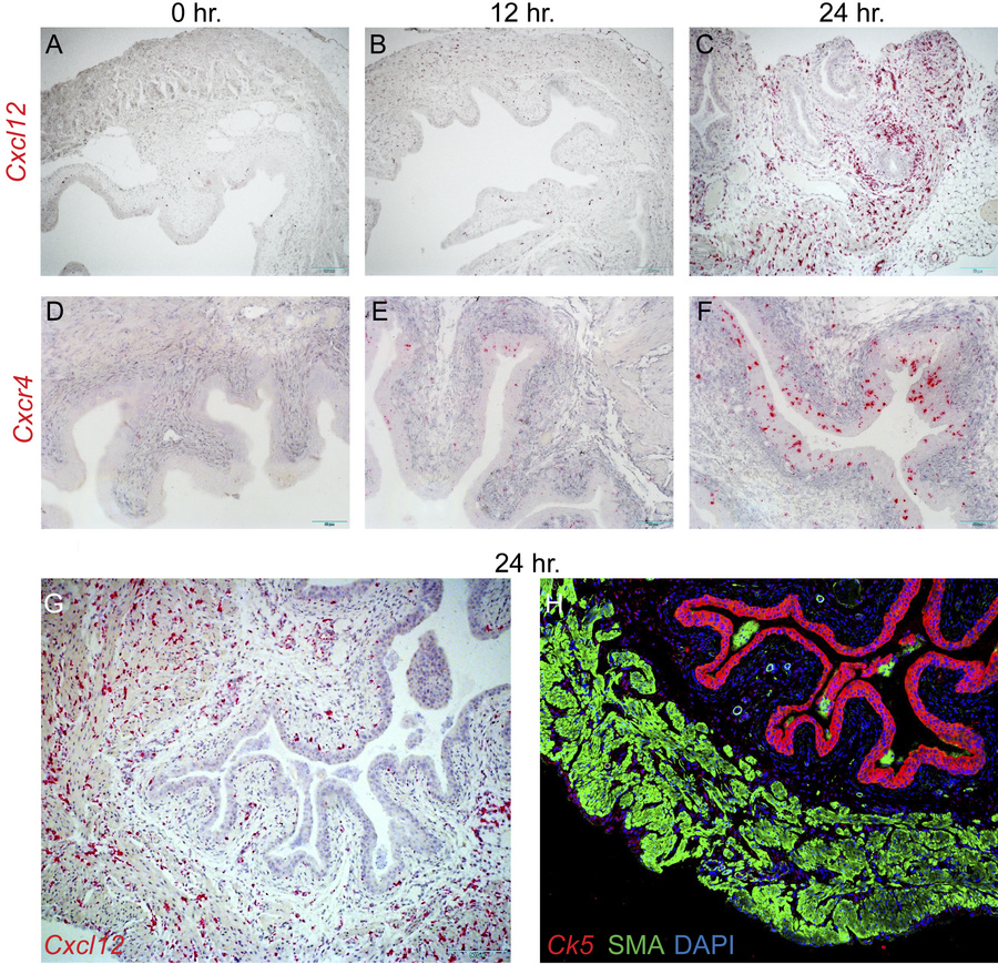 Increased Cxcl12 and Cxcr4 expression after UTI in mouse bladder.
Cxcl12...