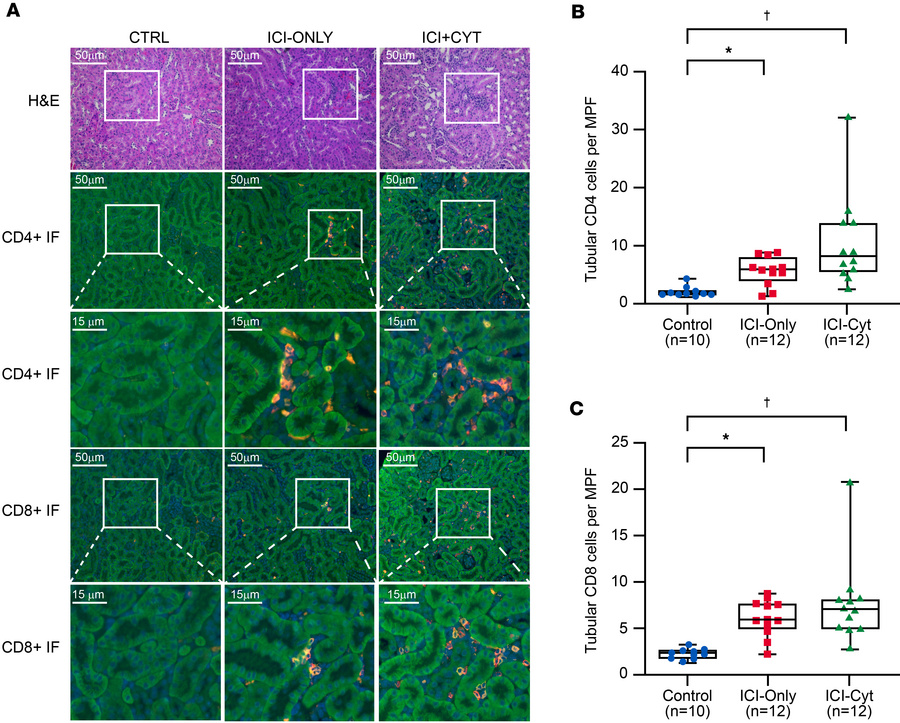 CD4+ and CD8+ tubular T cell number by immune checkpoint inhibitor treat...