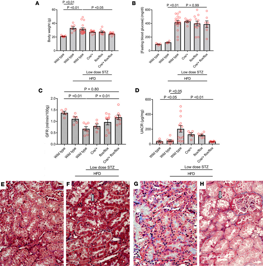 Conditional proximal tubule FATP2 deletion ameliorates HFD + STZ–induced...