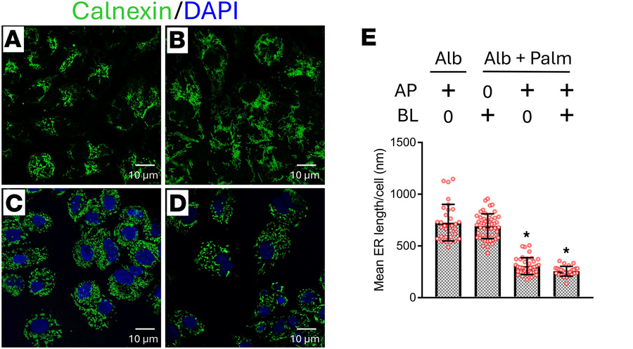AP palmitate causes ER fragmentation.
(A–D) ERs were labeled with calnex...