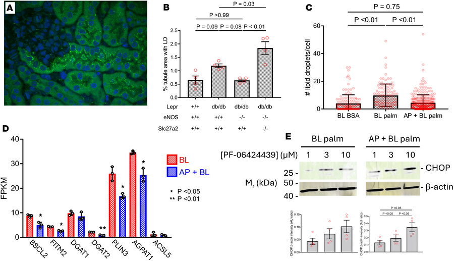 In vivo and in vitro models are associated with decreased LD biogenesis....